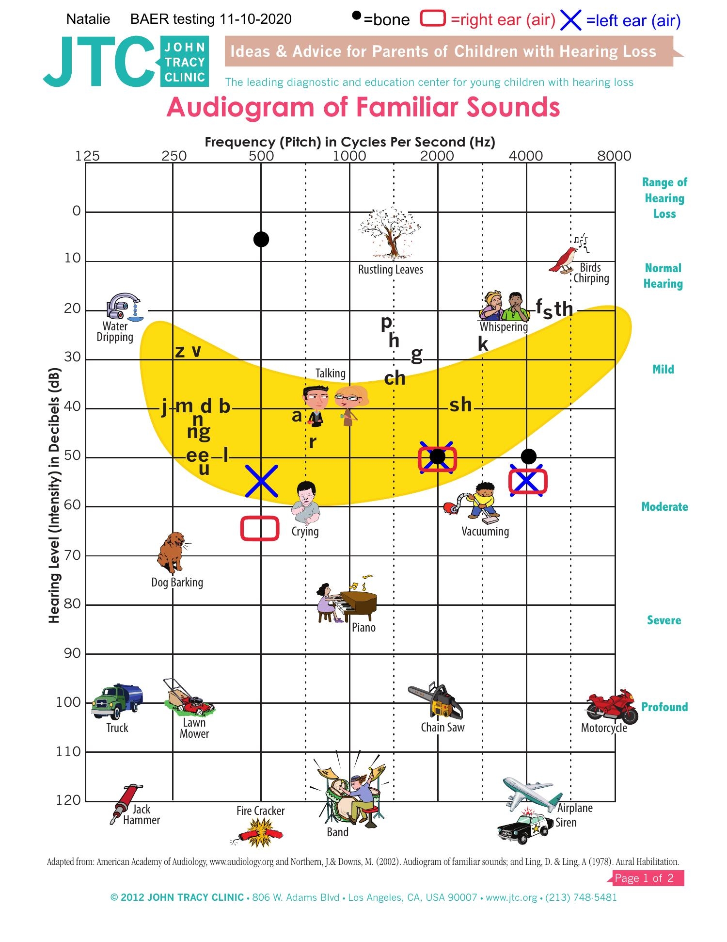 Editable Audiogram With Familiar Sounds Speech Banana Audiogram Printable
